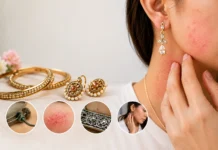 आर्टिफिशियल ज्वेलरी से एलर्जी क्यों होती है? कारण और बचाव Artificial Jewellery Se Allergy Kyu Hoti Hai - skin rash and itching